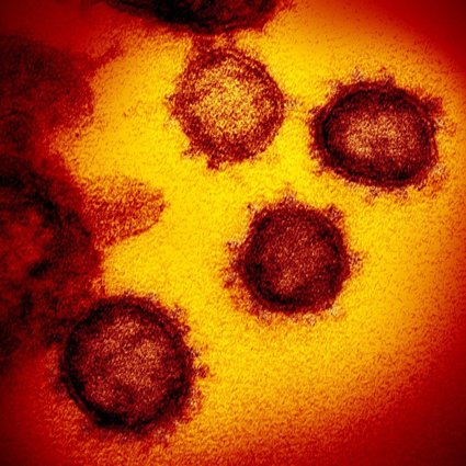 A close-up of the COVID coronavirus. 