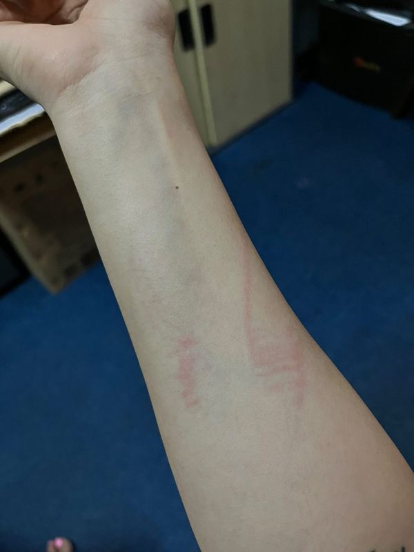 As a result of the altercation, Soda sustained injuries to her back and forearm. Source: @lucidsoda