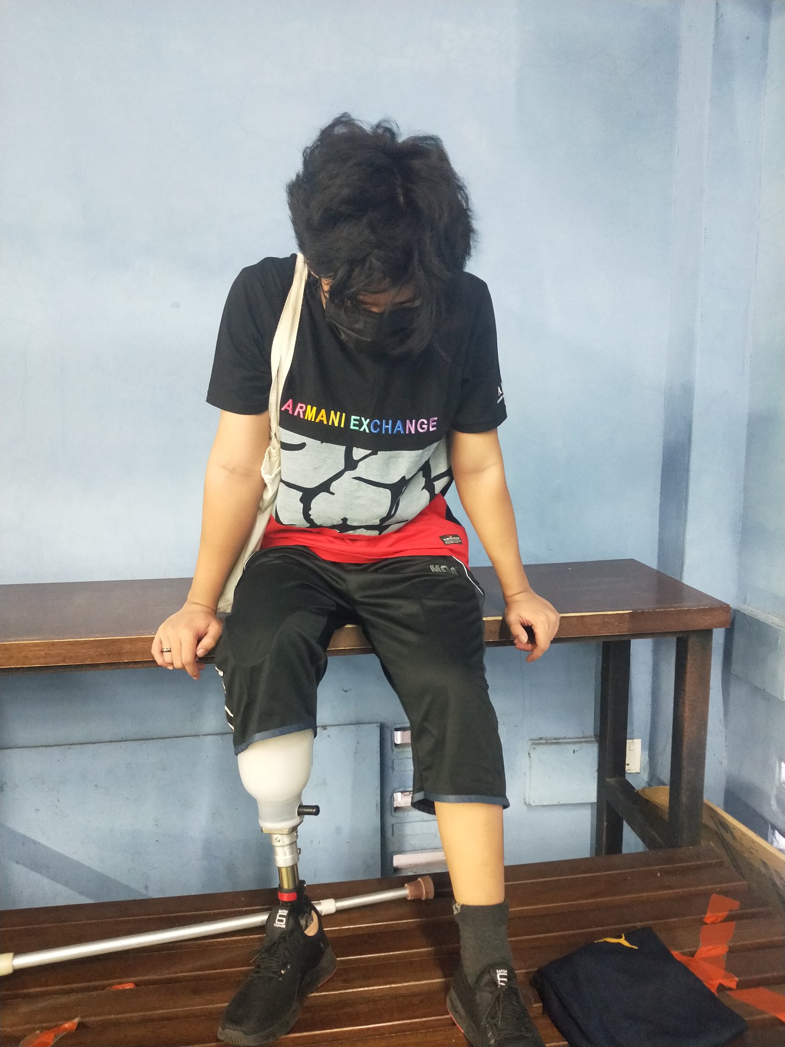 Sofwan has had his right leg amputated below the knee in 2019. Source: @sofw4n_