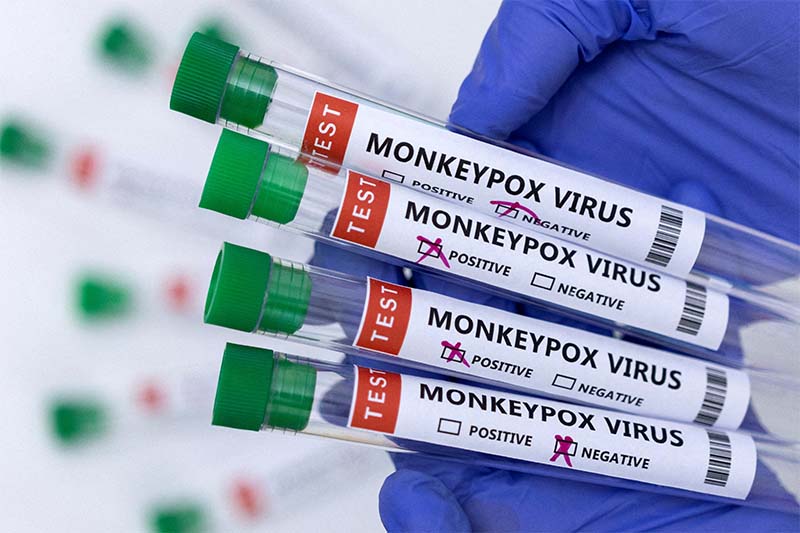 Singapore has recorded its very first local case of monkeypox. Image credit: interaksyon