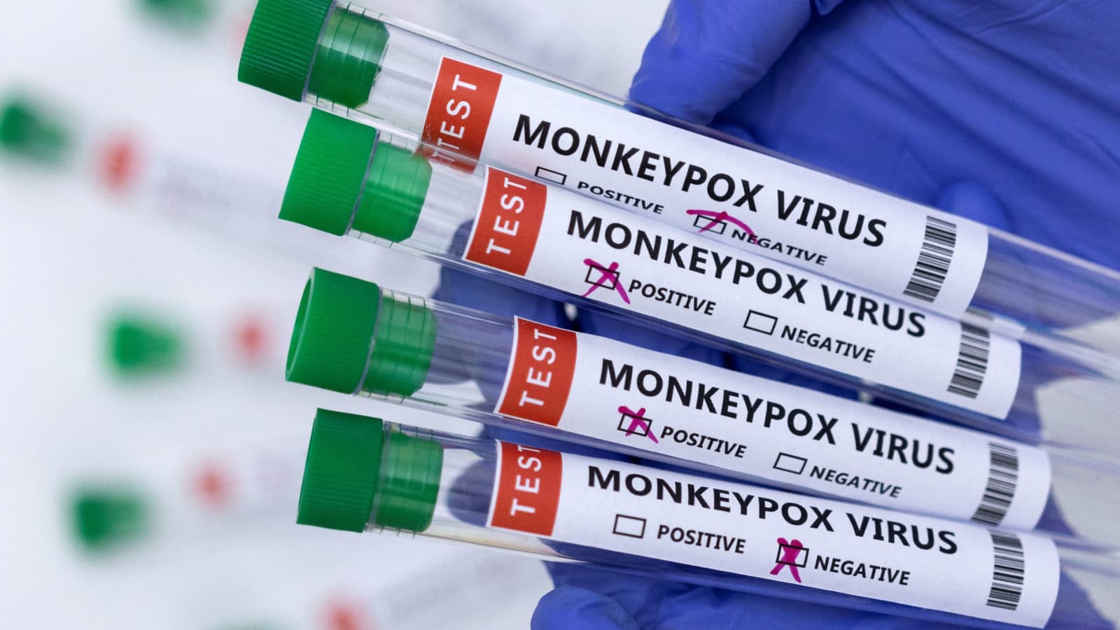 As of present, 16,000 monkeypox cases have been identified so far. Image credit: CNBC