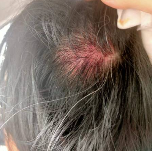 The woman sustained injuries as a result of the fight with the hawker. Image credit: China Press
